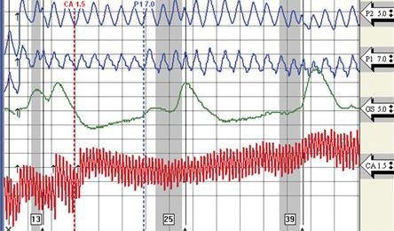 Price of a Los Angeles polygraph test is $139